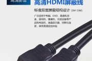 机顶盒连接笔记本困难？如何正确连接？