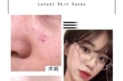 美颜相机应用无法关闭怎么办？