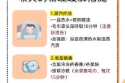 如何缓解吹空调引起的喉咙痒（有效的方法和注意事项）