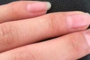 苹果手机壳上的白点代表什么？