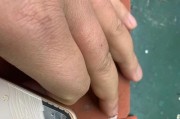 苹果碎片脱水保存到手机的方法是什么？