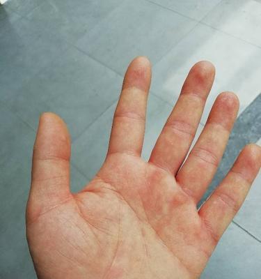 苹果手机如何设置手掌拍照？手掌拍照功能有什么特点？