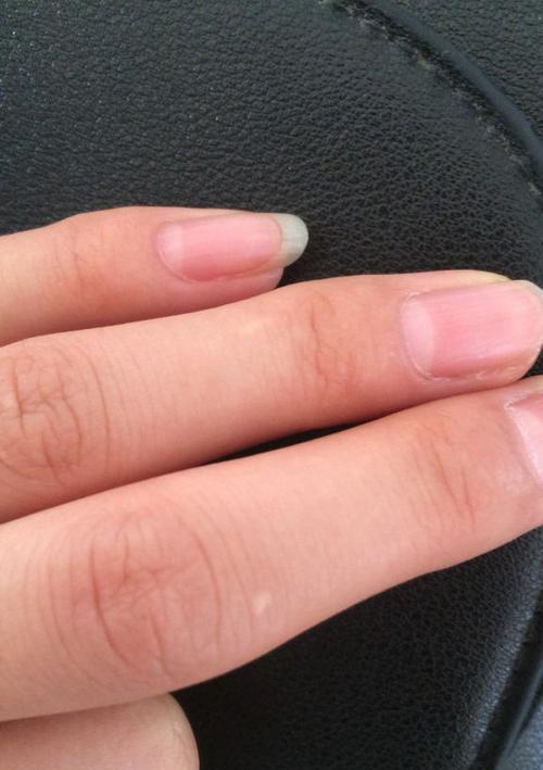 苹果手机壳上的白点代表什么？